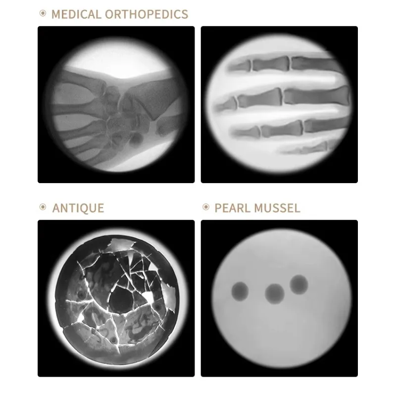 Juzheng Handheld X-ray Fluoroscopy Machine Hyperlight Portable Xray Machine Digital