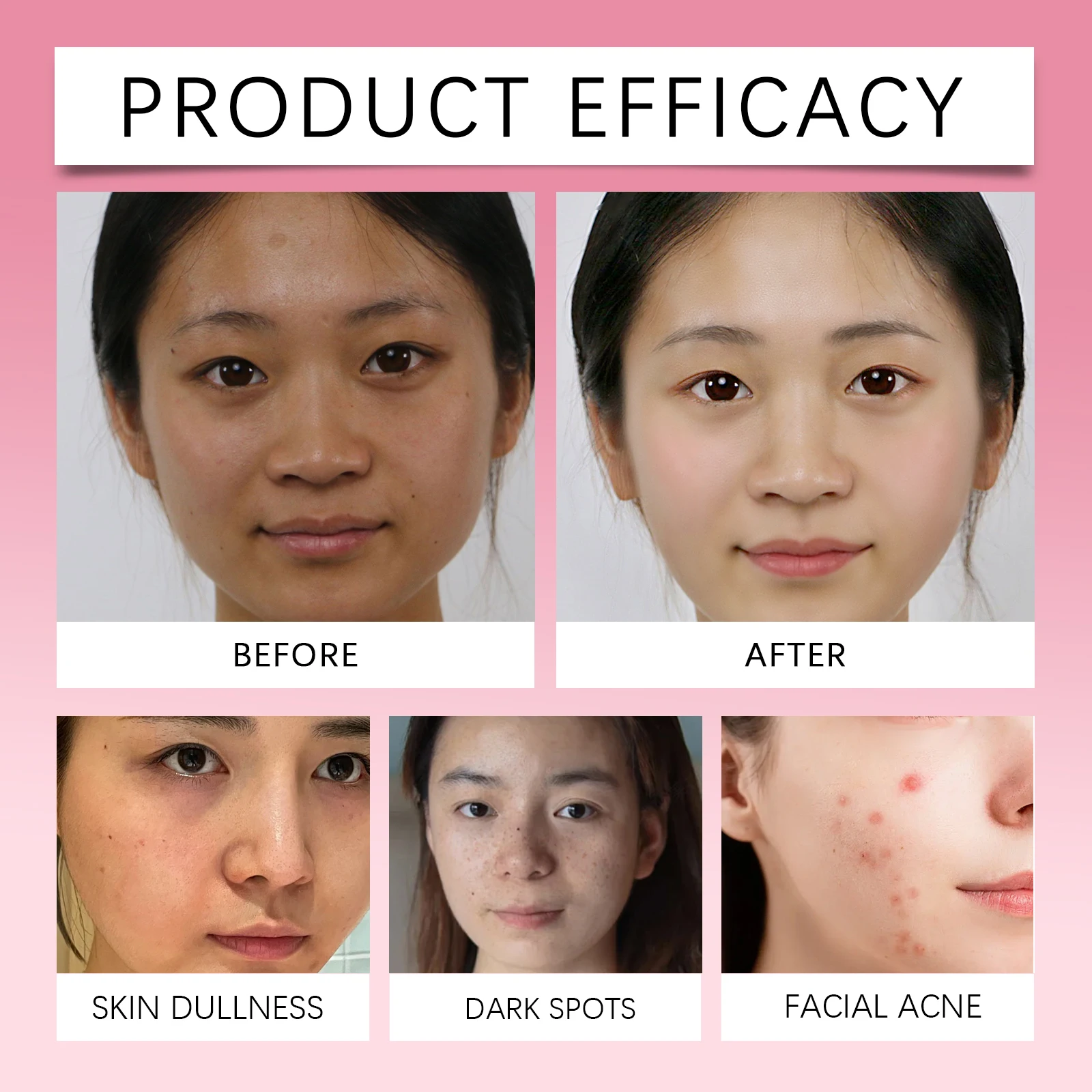 Kojic Acid Turmeric Facial Pad - đánh giá và giá Kojic Acid Soap