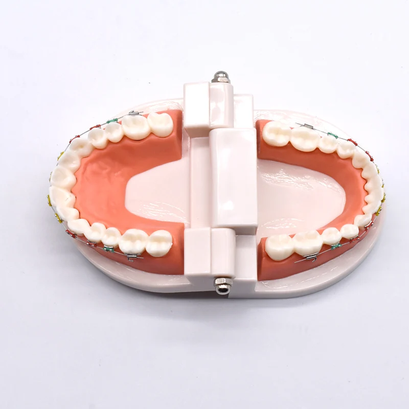 

1 Pcs Dental Demonstration Orthodontic Model with Metal Wires and Metal Bracket