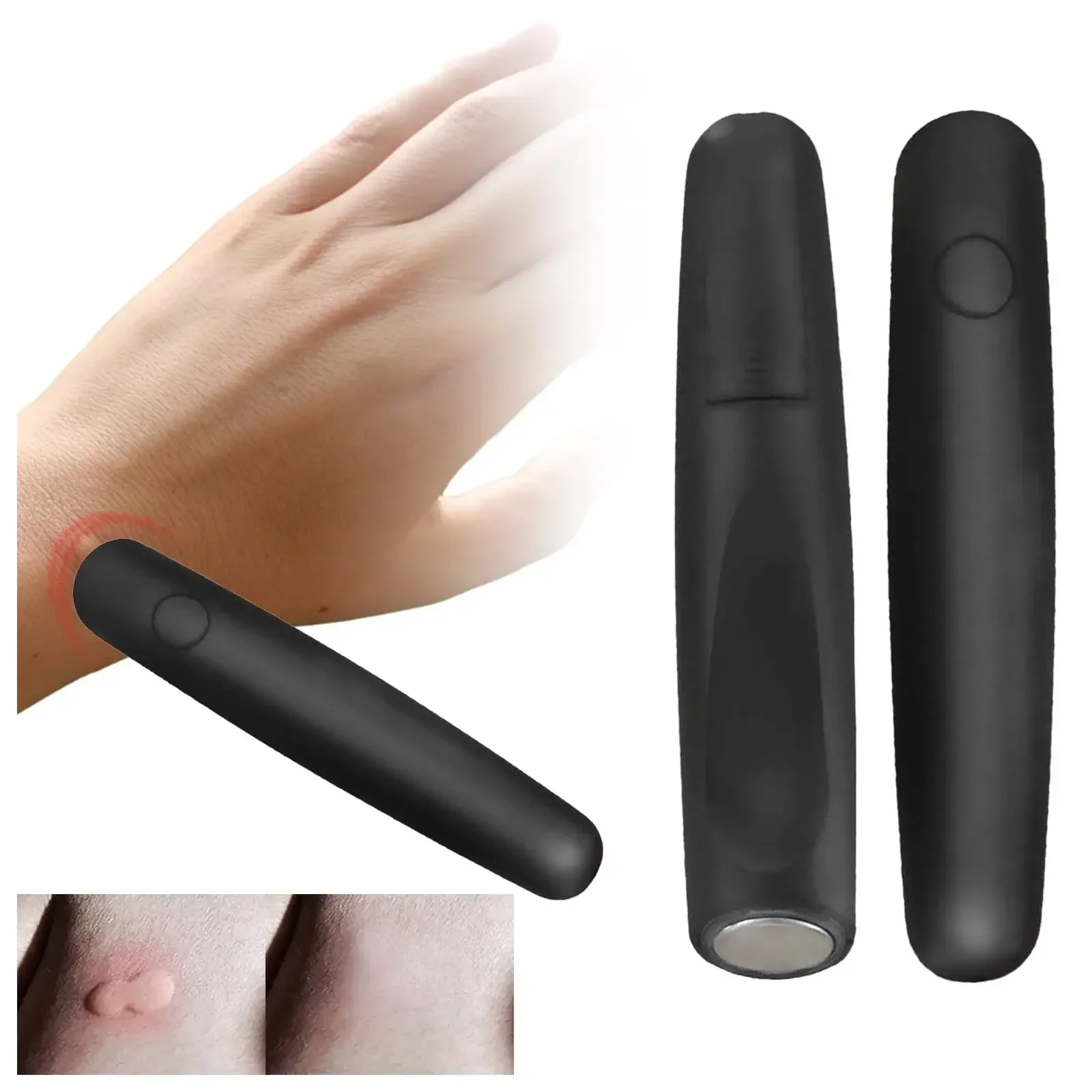 Electronic Mosquito Bite Relief Pen Portable Itch Swelling Pain Soother Insect Sting Relief Tool Outdoor Camping Travel Summer