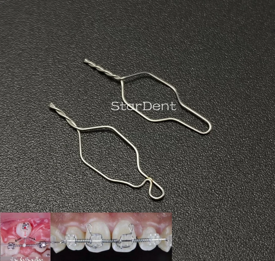 100Pcs/Pack Dental Orthodontic Kobayashi Wire Archwires Short Twist Weld Metal Ligature Tie Preformed ligature Bracket