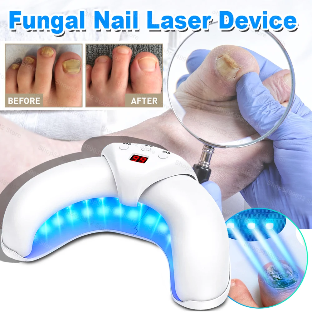 Nail Fungus Laser Treatment Device Repair Toenail Fingernail Fungus Treat Onychomycosis Therapy Cure Machine Effectively Remove