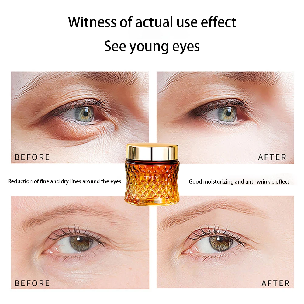 

A Alcohol Bifid Yeast Eye Cream Anti-wrinkle Remove Black Eye Circles Anti-Aging Brighten For Eye Soothing Firming Eye Cream