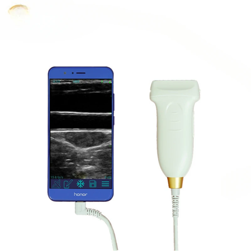 

Portable Type C linear mini ultrasound machine laptop probe