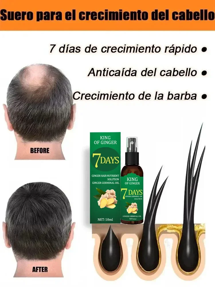 Obtenga más cabello, diga adiós a la calvicie y el cabello grueso. vender como pan caliente