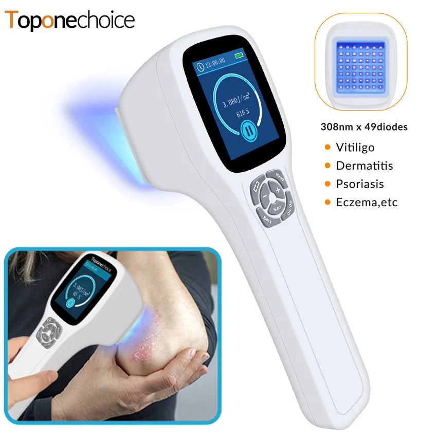 

49 Diodes 308nm Excimer UVB Light Therapy For Vitiligo Psoriasis Eczema Ultraviolet Phototherapy Instrument 5-40mW/cm²