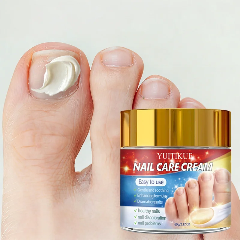 Yuitikue Nail Care Cream, 60g Gentle Nail Repair Cream for Nail Discoloration & Nail Problems, Promoting Healthy Nails
