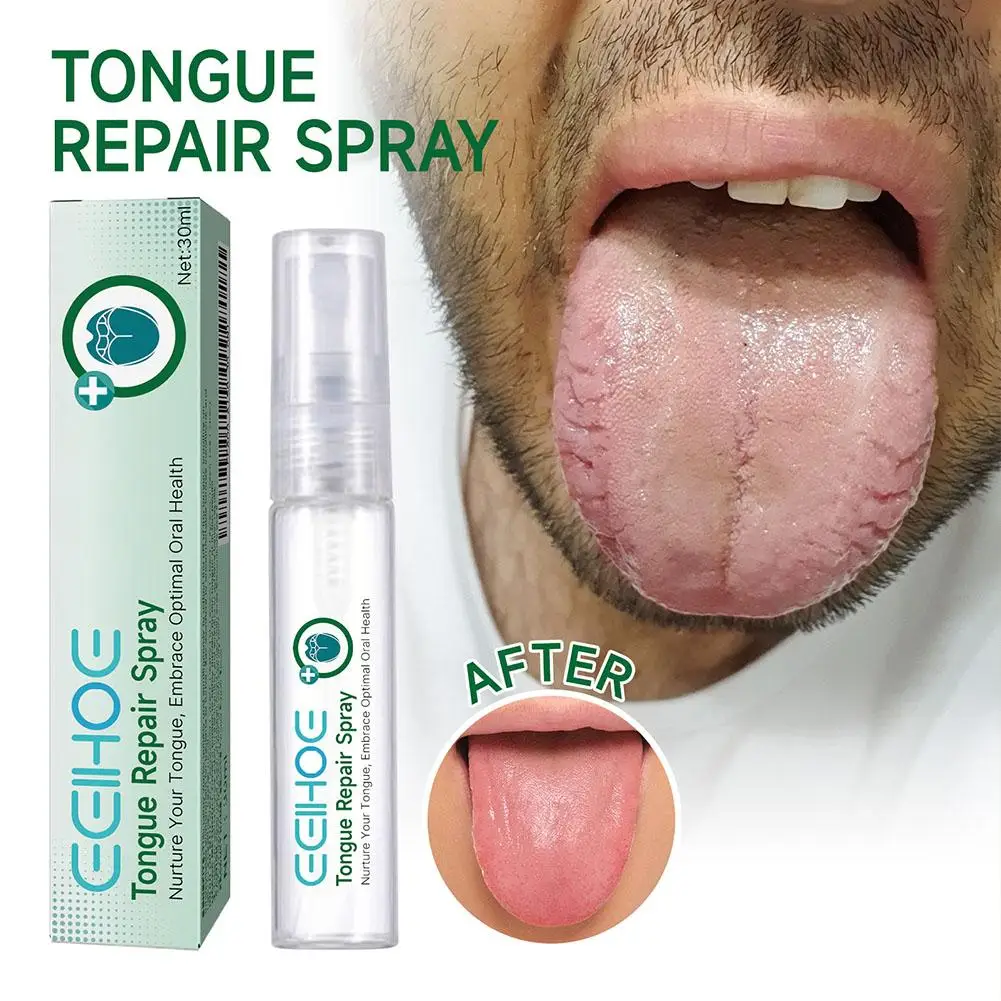 EELHOE Tongue Repair Spray Repair Tongue Whitening Dry, Oral Spray Cracked Care Swollen Relieve Tongue To And A0T7