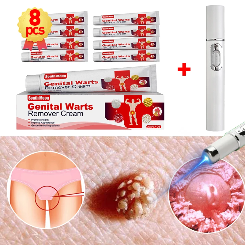 

Genital Warts Removal Laser Pen for Men and Women Condyloma Treatment Genitals Private Antibacterial Anus Wart Removal