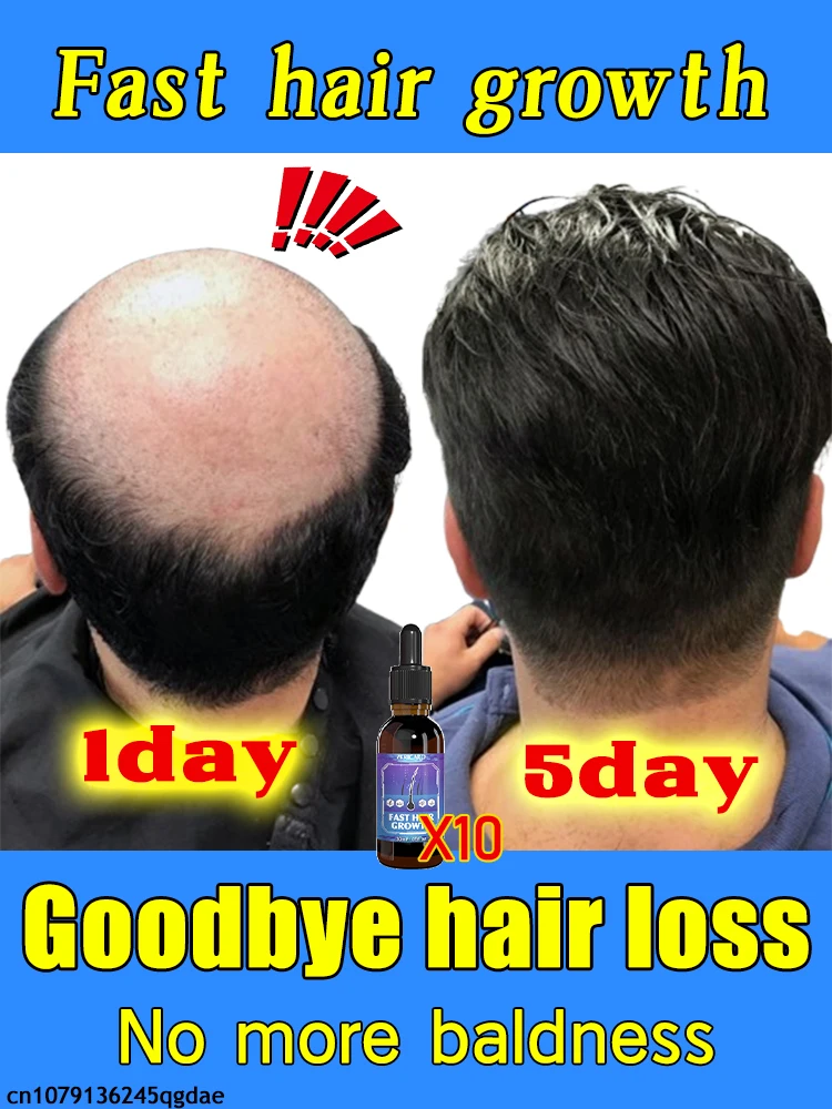 

If you have hair problems, the little blue bottle hair growth essence can help you improve baldness and help hair growth