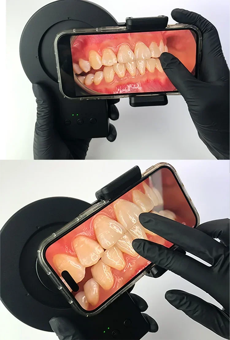 2026/Full Medical photography ring filling light   macro photography flash light Manufacturers