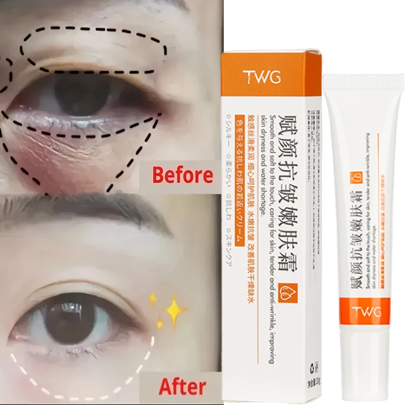 Retinol Anti-Falten-Augen creme entfernen Augen taschen dunkle Ringe verblassen feine Linien Anti-Aging-Schwellungen fest aufhellen straffende Augen pflege