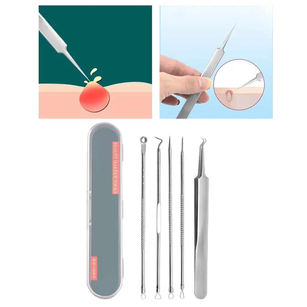 2-4 opakowanie zestawu do usuwania zaskórników na trądzik Extractio do usuwania zaskórników