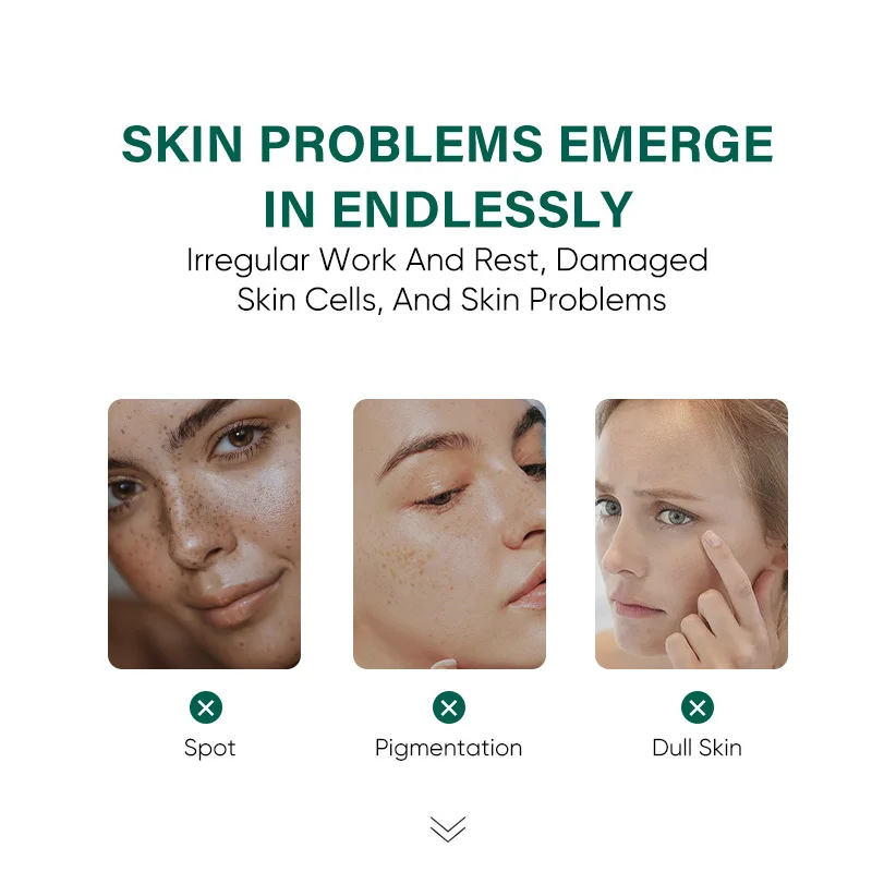 Dark Spot serum Fades Sunspots Brightens Dull Skin Nourishes skin Reduces Melanin Minimizes freckle for men and women