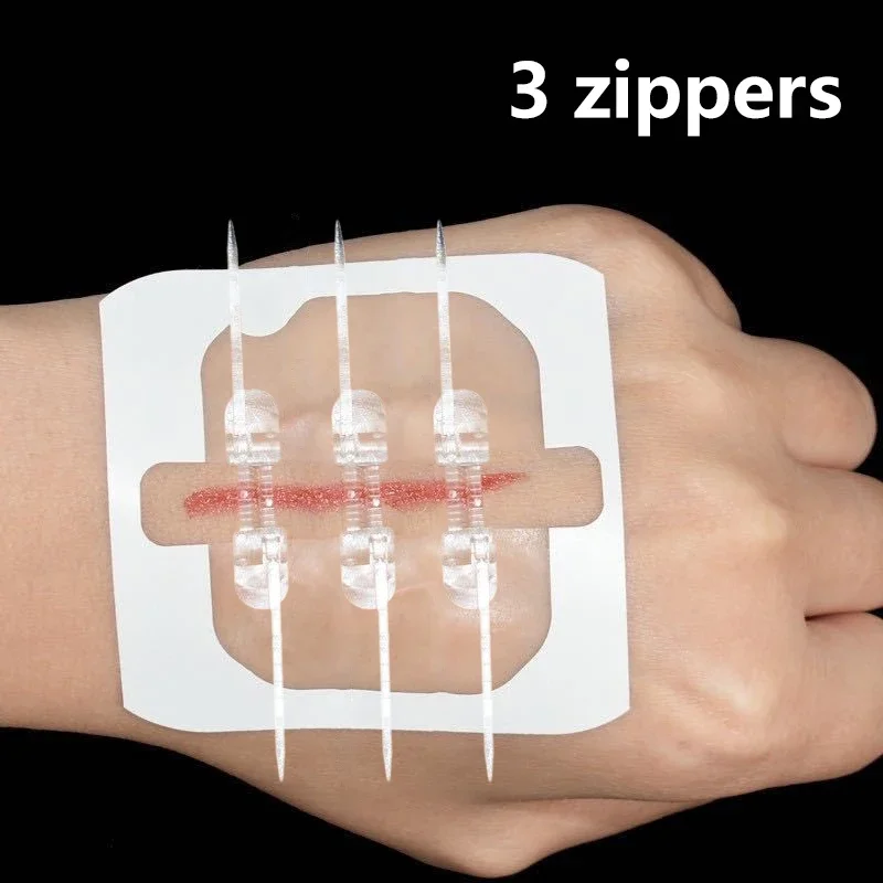 

1 Pcs Zipper Tie Wound Closure Patch Hemostatic Patch Wound Fast Suture Zipper Band-Aid Outdoor Portable