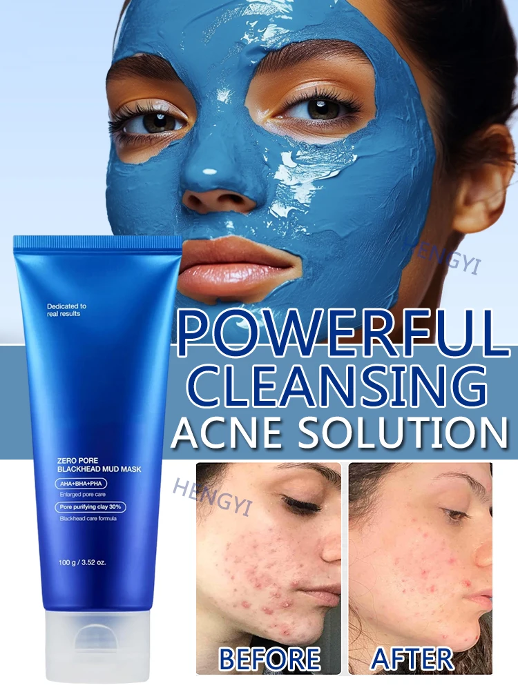 

Deep Cleansing Korean Mud Clay Mask Acne Zero Pore Blackhead Skin Cooling Pore Tightening With AHA BHA PHA Powerful Skin Care