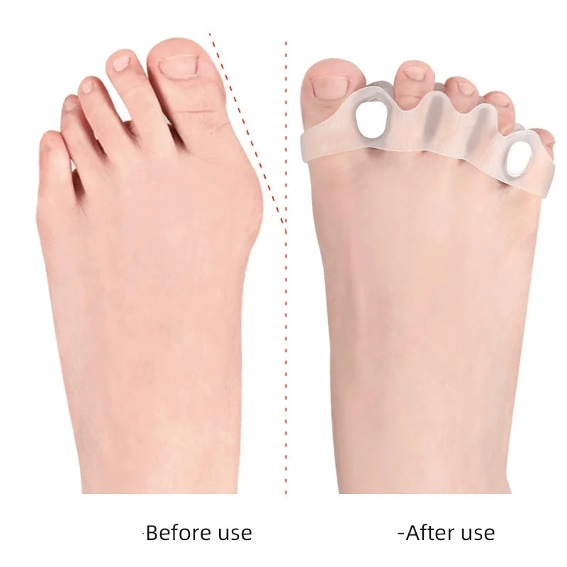 Thumbnail 4 - #7 Trending Pedicure Spacers Right Now