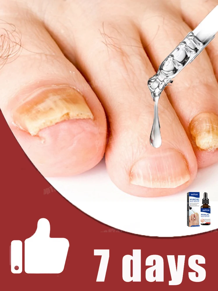 Hot cleaning nail brush tools, plastic vacuum cleaners, Say goodbye to nail troubles more discounts on sets