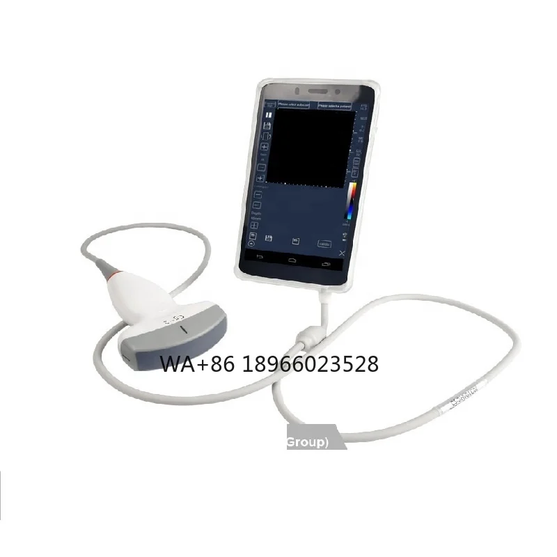 Sonography Diagnostic Scanner with CE ISO Portable Ultrasound Machine     and  medical ultrasound