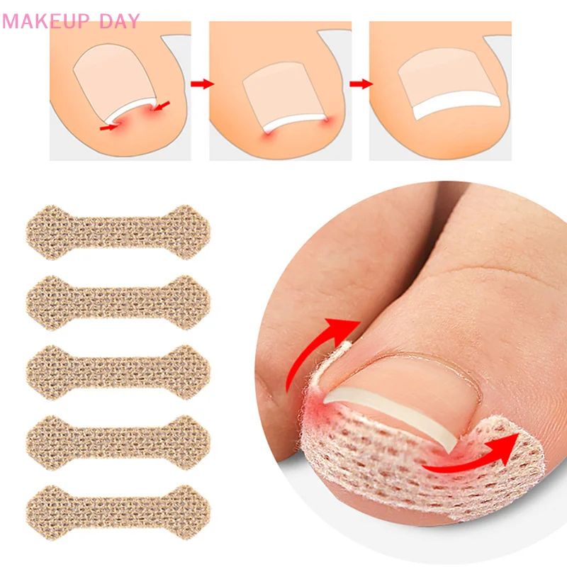 4/10 Vellen Pedicure Ingegroeide Nagel Gereedschap Teennagel Stickers Voor Nagel Corrector Paronychia Behandeling Fixer Herstellen Bunion