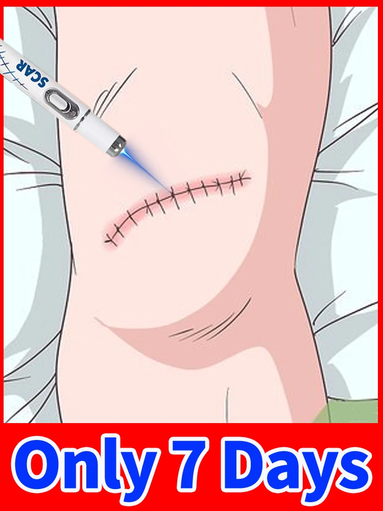 

Scar disappearance is not a dream