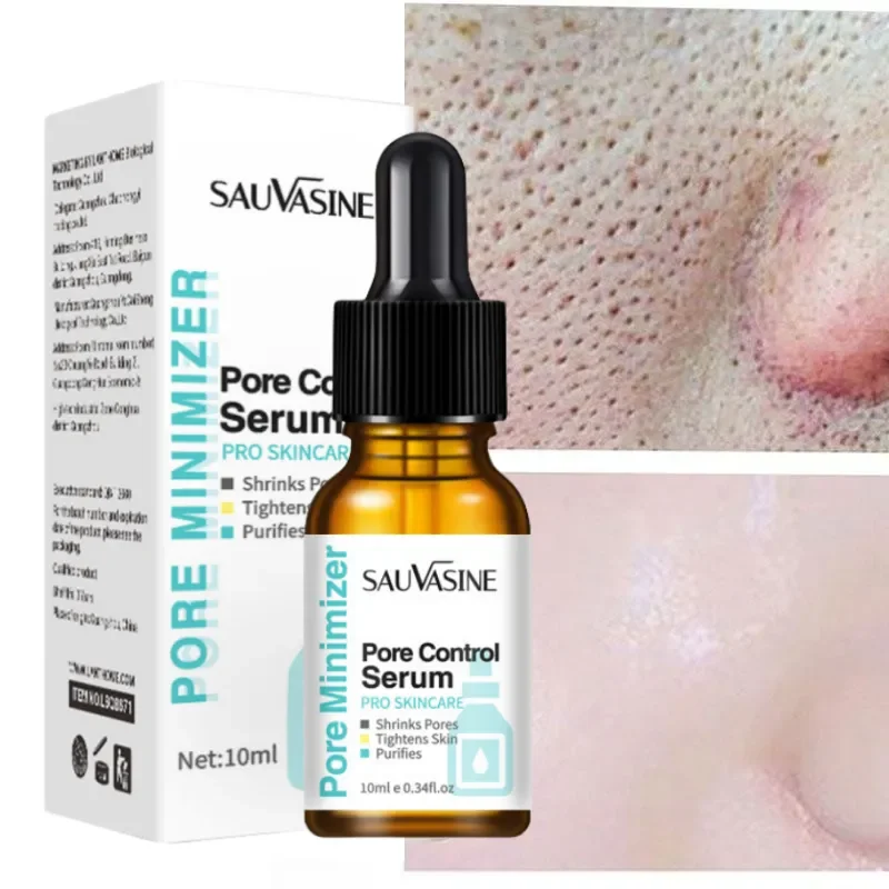 Essence de réduction des pores remodelée, points noirs, marques d'acné, prévention des pores élargis, réparation de la peau du visage, hydratant, soins de la peau