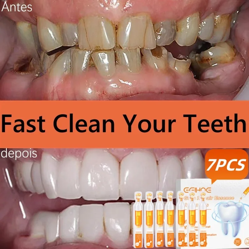 

Quickly Repair Gum Serum Relieve Receding Gum Regrowth Drops Teeth Whiten Remove Yellow Plaque Stains Decay Toothache Toothpaste