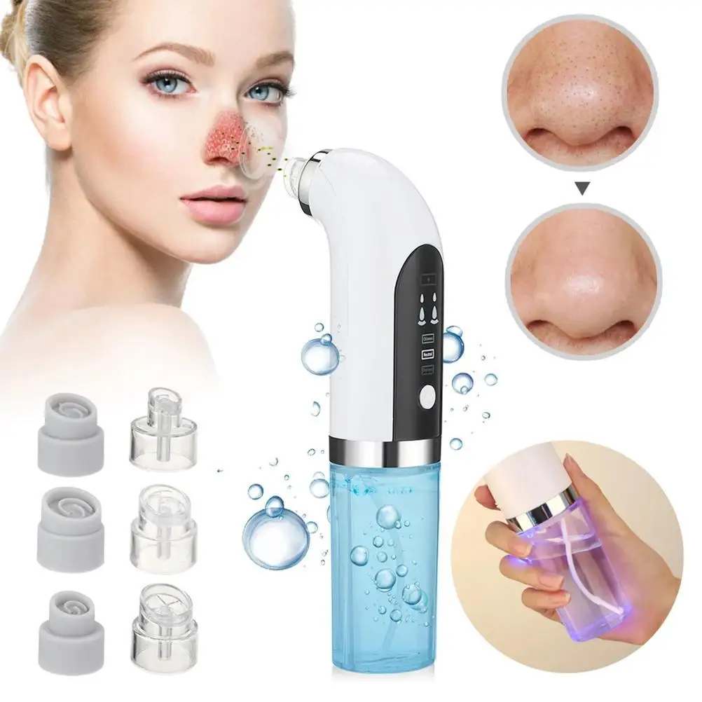 Blackhead Remover Pore สูญญากาศ 3 ถ้วยดูดแบบปรับได้มือถือ Easy ไฟฟ้า Blackhead เครื่องดูดฝุ่น ABS สําหรับ Home