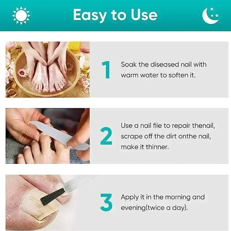 Toenail Nail Fungus Treatment Repair Fingernail Device Toenail Treatment for Foot Nail Fungus Essential Oil Onychomycosis Care