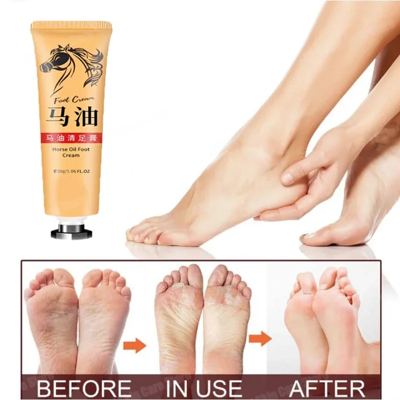 Horse Oil Skin Cream Anti-cracking Ointment Prevents Dry Skin Moisturizes Protects Fingers Feet And Skin Care Products