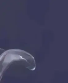 

4 шт./компл., внутриротовой ретрактор для щек, открывалка для губ, размер, маленький + большой ортодонтический материал для рта в виде зубов, черная Т-образная двойная головка