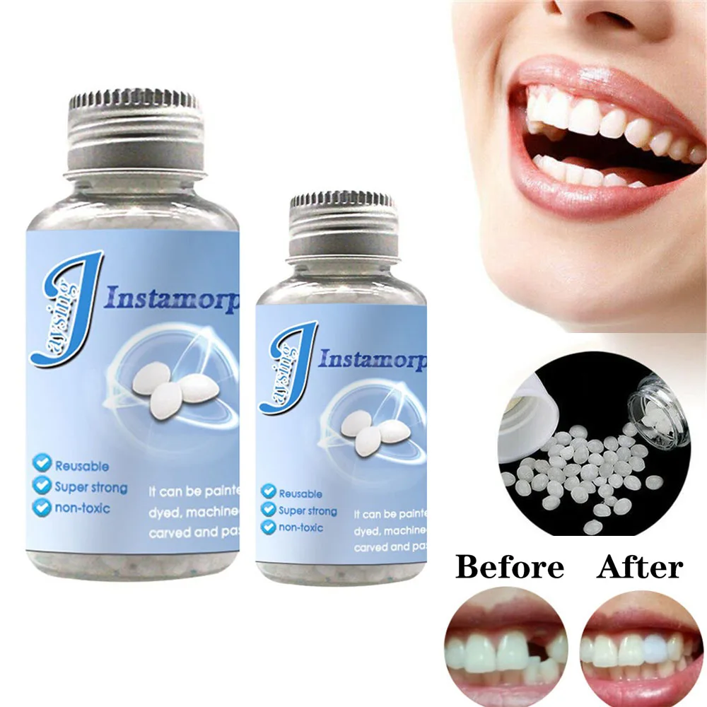 

Denture Decorative Denture Denture Solid Tooth Gel Tooth Repair Kit Temporary Tooth Filling Material Tooth Replacement Material