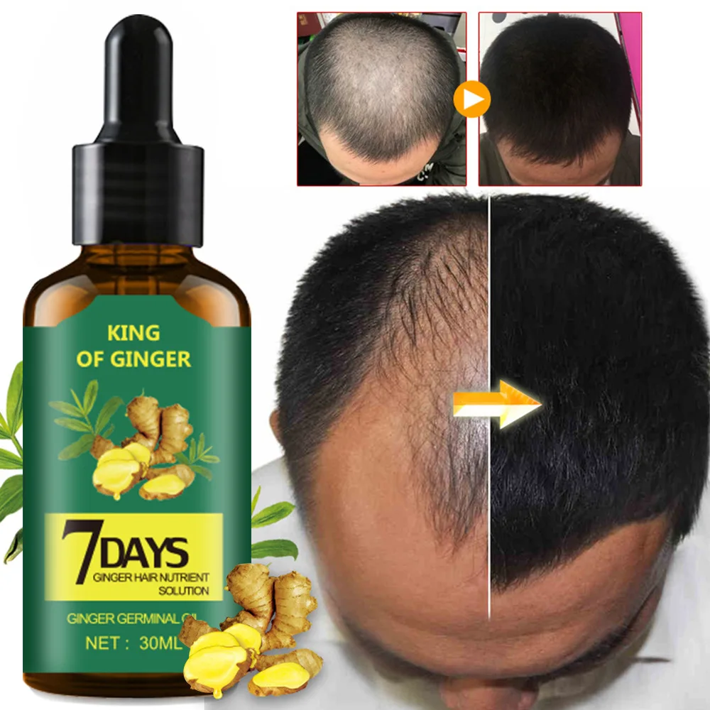 

Ginger Hair Growth Serum – 30ml. Specially formulated with ginger root extract to effectively reduce hair loss, thicken hair, an