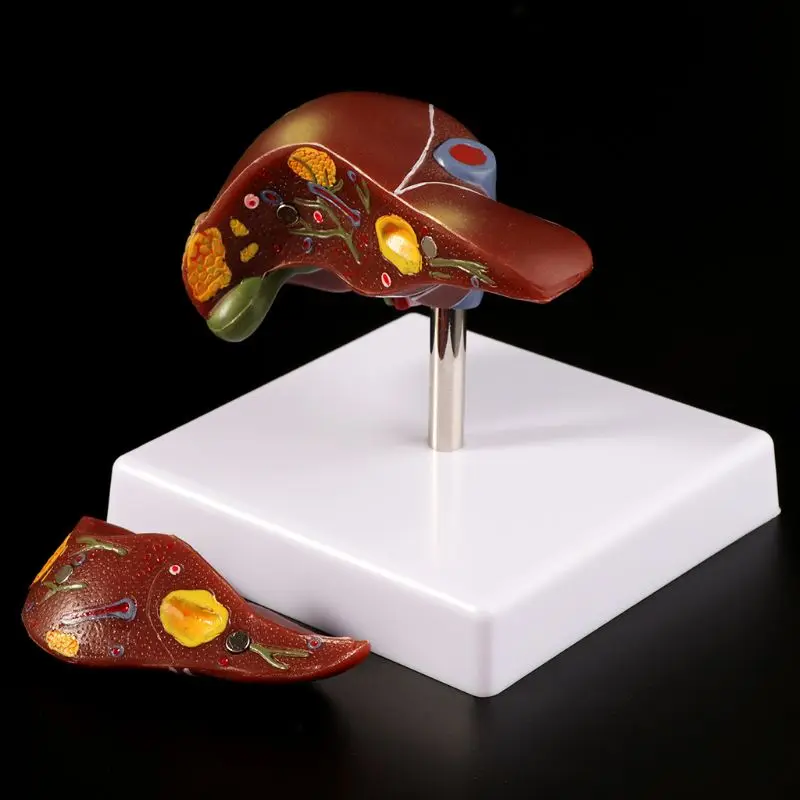 Human Liver Pathological Anatomical Model Anatomy School Medical Teaching Displa