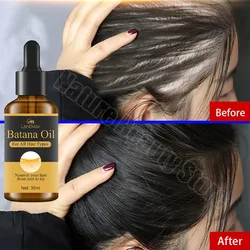 Soro de crescimento rápido do cabelo para homens e mulheres, anti-perda, cabelo rebrota produtos, reparação danificado cabelo raízes, cuidados com o cabelo, 7 dias, Batana