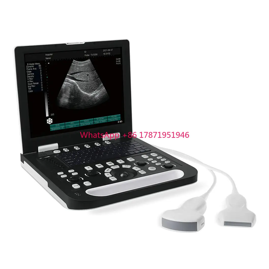 

15 inch Full Digital Color Doppler Ultrasound Diagnostic System Portable ultrasonic scanner for vet and human