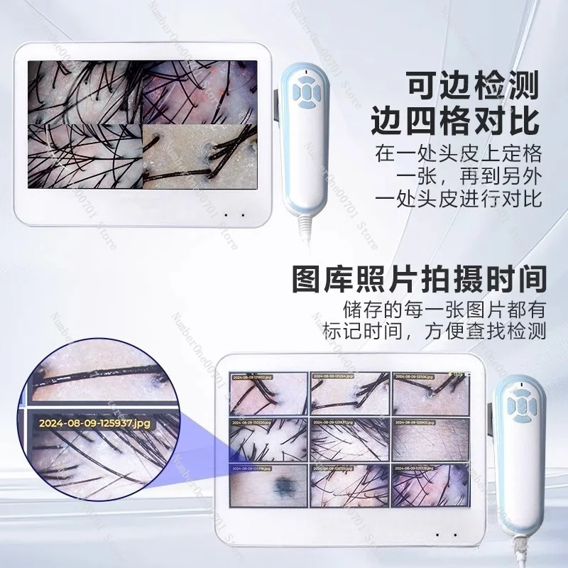 Scalp Tester Hair Follicle Analyzer for Head Care 1080P HD Skin Scanner Anti-Hair Loss Inspection Camera Machine