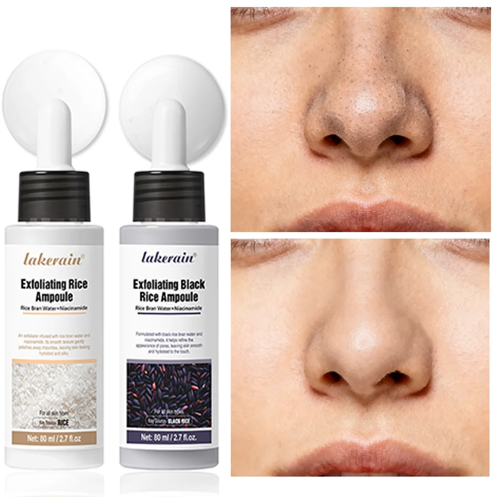 Ampolla exfoliante de arroz, exfoliante suave para cara y cuerpo, eliminador de espinillas de células muertas para todo tipo de piel, cuidado coreano de la piel