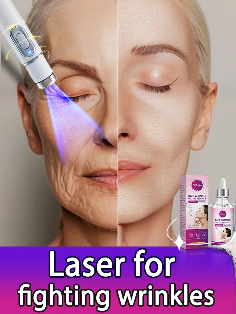 Anti-Wrinkle Laser Pen - Turn Back Time and Look 20 Years Younger!