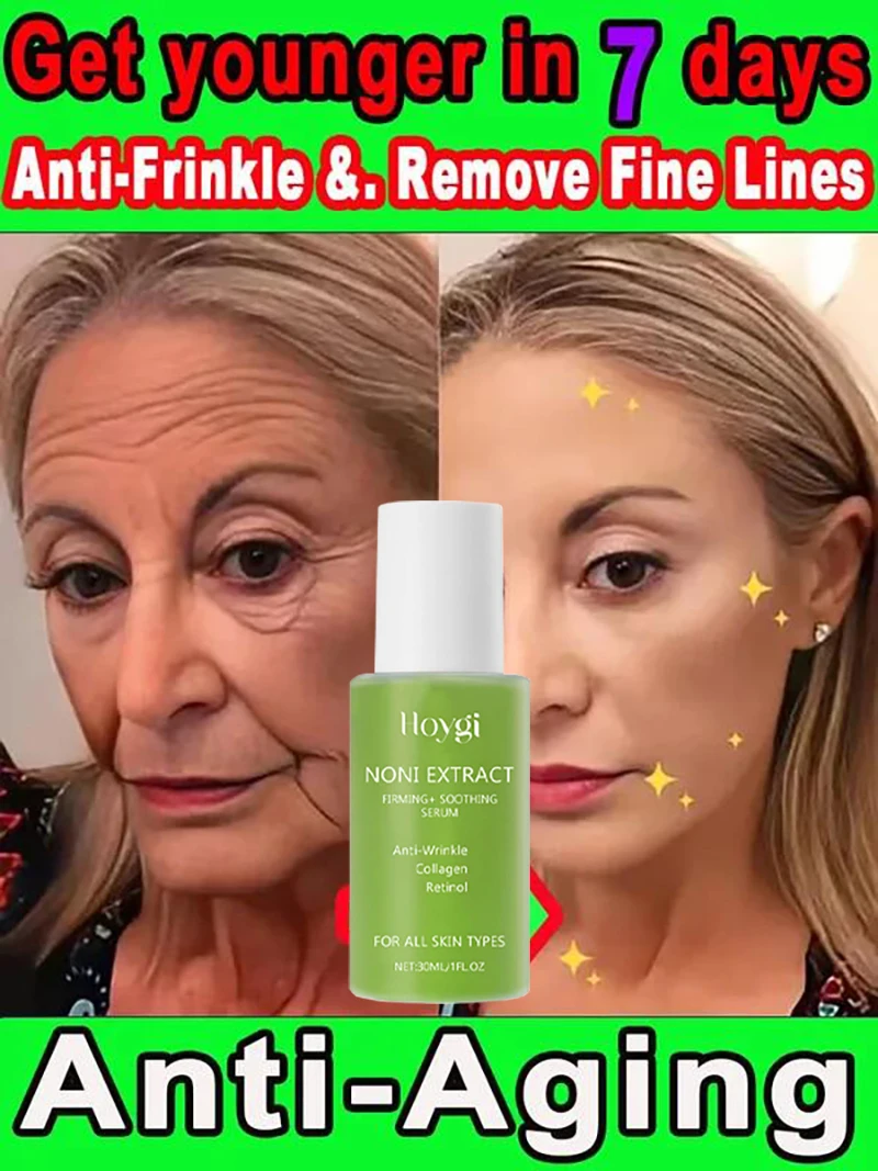 

Noni Fruit Essence Noni Extract Energy Ampoule Face Serum Anti-wrinkle Moisturizing Soothing Wrinkle Fine Line Korean Skin Care