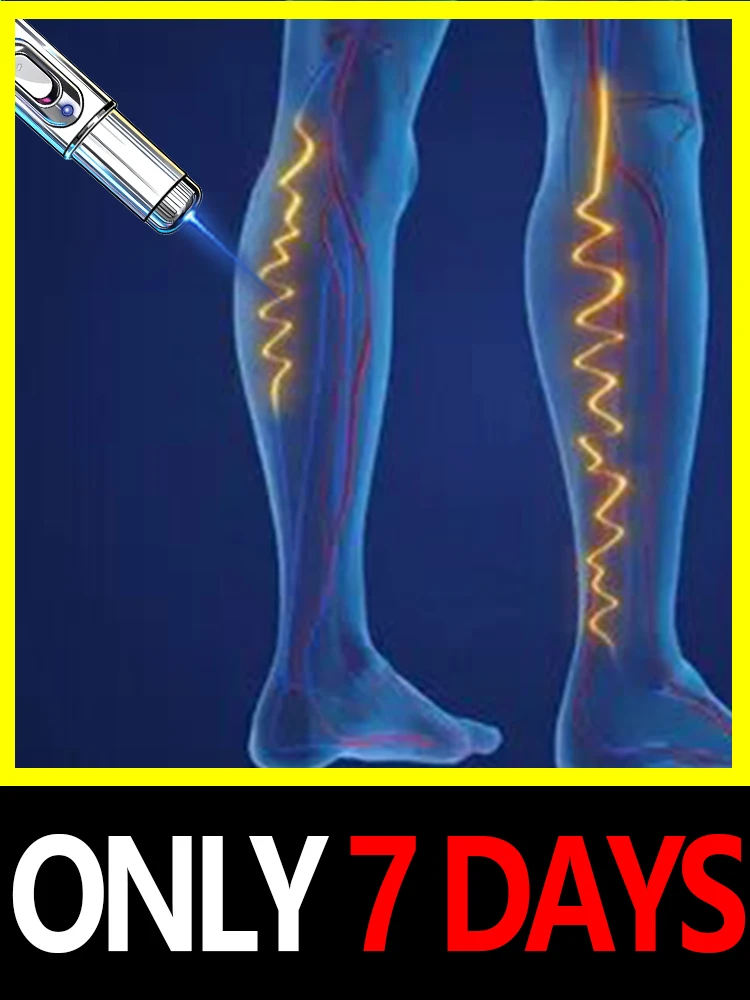 Versione aggiornata del 2025 dell'utensile di seconda generazione per la riparazione laser a luce blu delle vene varicose