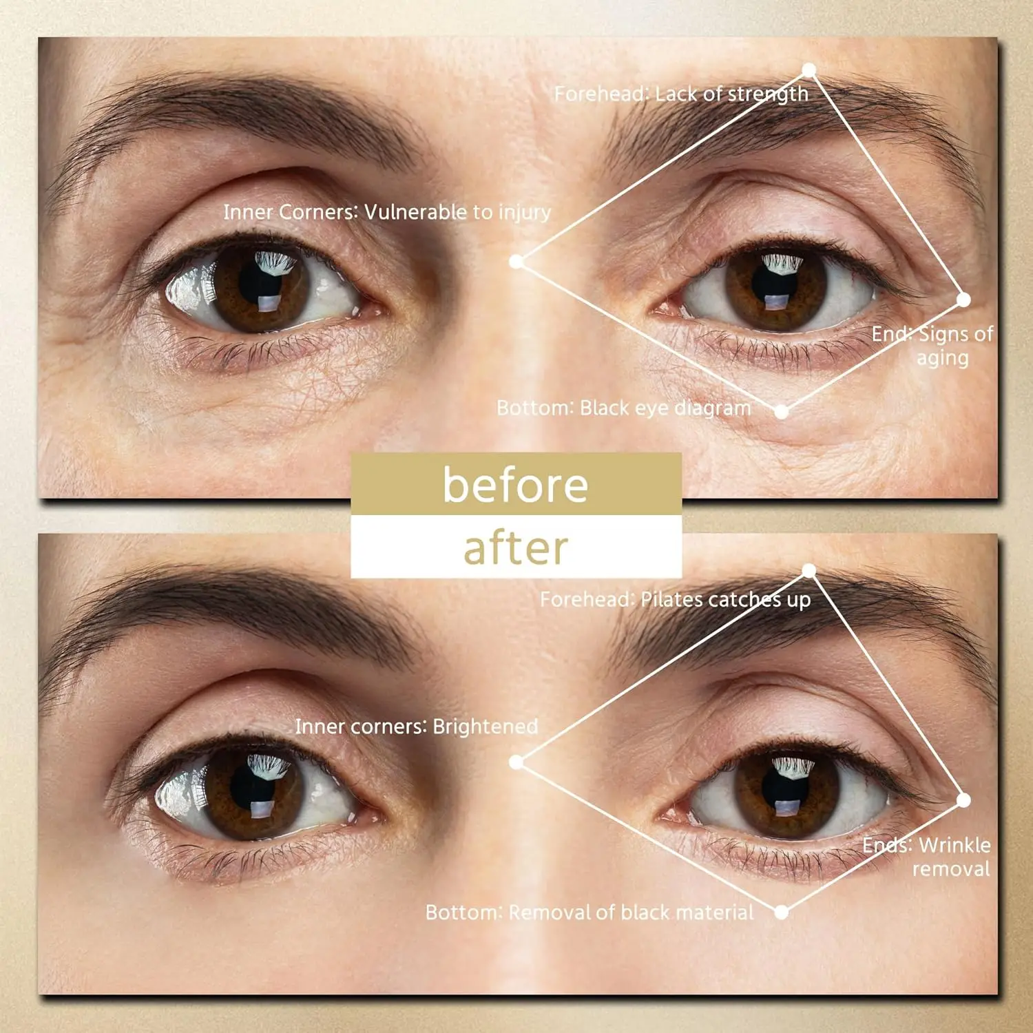 2025 venda quente outro uso doméstico ems micro corrente mini dispositivo de beleza dos olhos terapia de luz vermelha sob os olhos massageador remendos instrumento