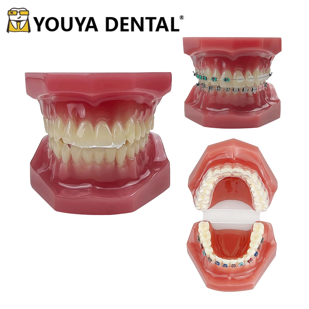 

Orthodontic Teeth Model Dental Teaching Model for Dental Student Studying Training Practice Doctor-patient Communication Tool