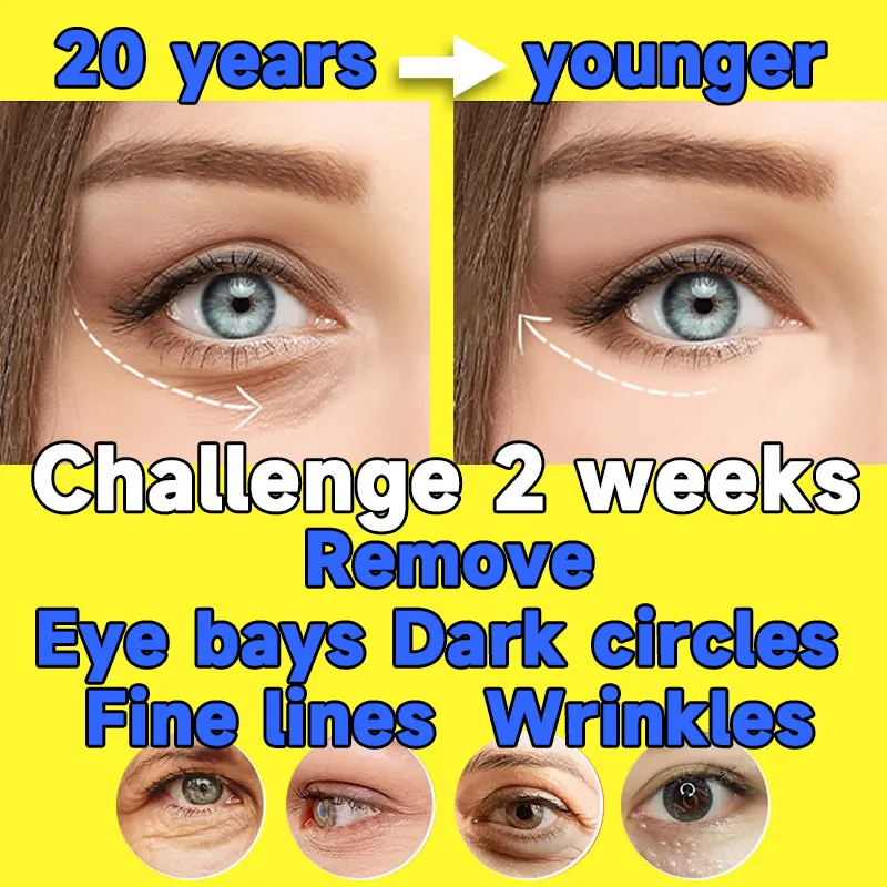 

Rejuvenating Moisturizing Eye Serum Eye Bag Remove Firm Roller Essential Oil Lighten Dark Circles Wrinkle Stick Nourish Eye Care