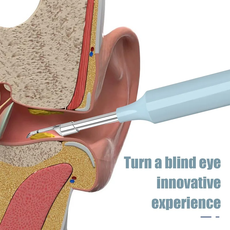 Wireless WIFI Ear Otoscopio Camera Intelligent Visualization Ear Scoop Medical Use High Resolution Glow Cleaning Ear Canal Tools
