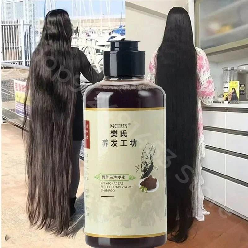 300ml Africa Women Traction Alopecia Treatment Hair Growth Product for Men Shampoo Hair Loss Treatment Get Rid of Wigs