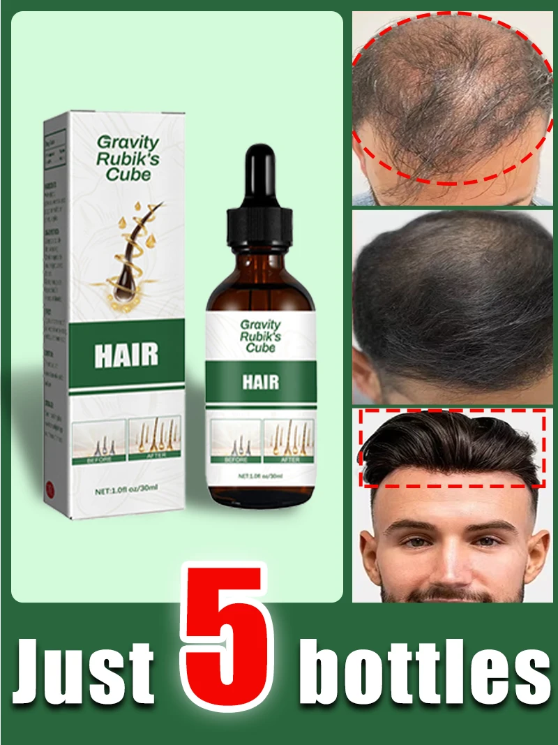 

Effective Hair Growth Oil Loss Repair Genetic Hair Loss Postpartum Hair Loss Seborrheic
