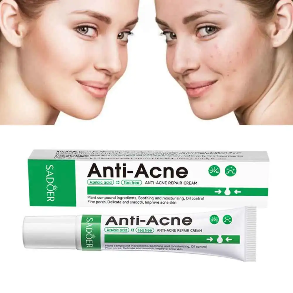 Effective Acne Removal Cream Effective Acne Removal Cream Oil Control Whitening Moisturizing Face Gel Skin