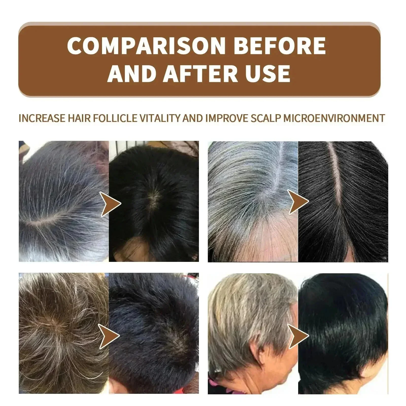 Thumbnail 4 - #56 Compare Hair Loss Treatments Before You Buy