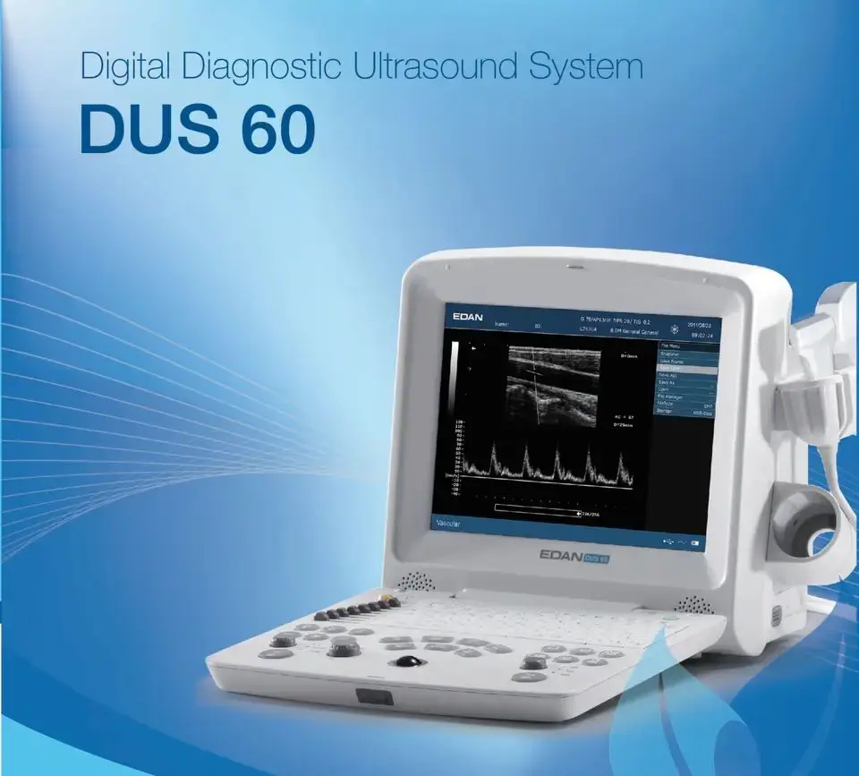 エダン-超音波スキャンマシン、USB、血管筋肉、USG、黒と白